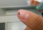 有什么药可以杀跳蚤？